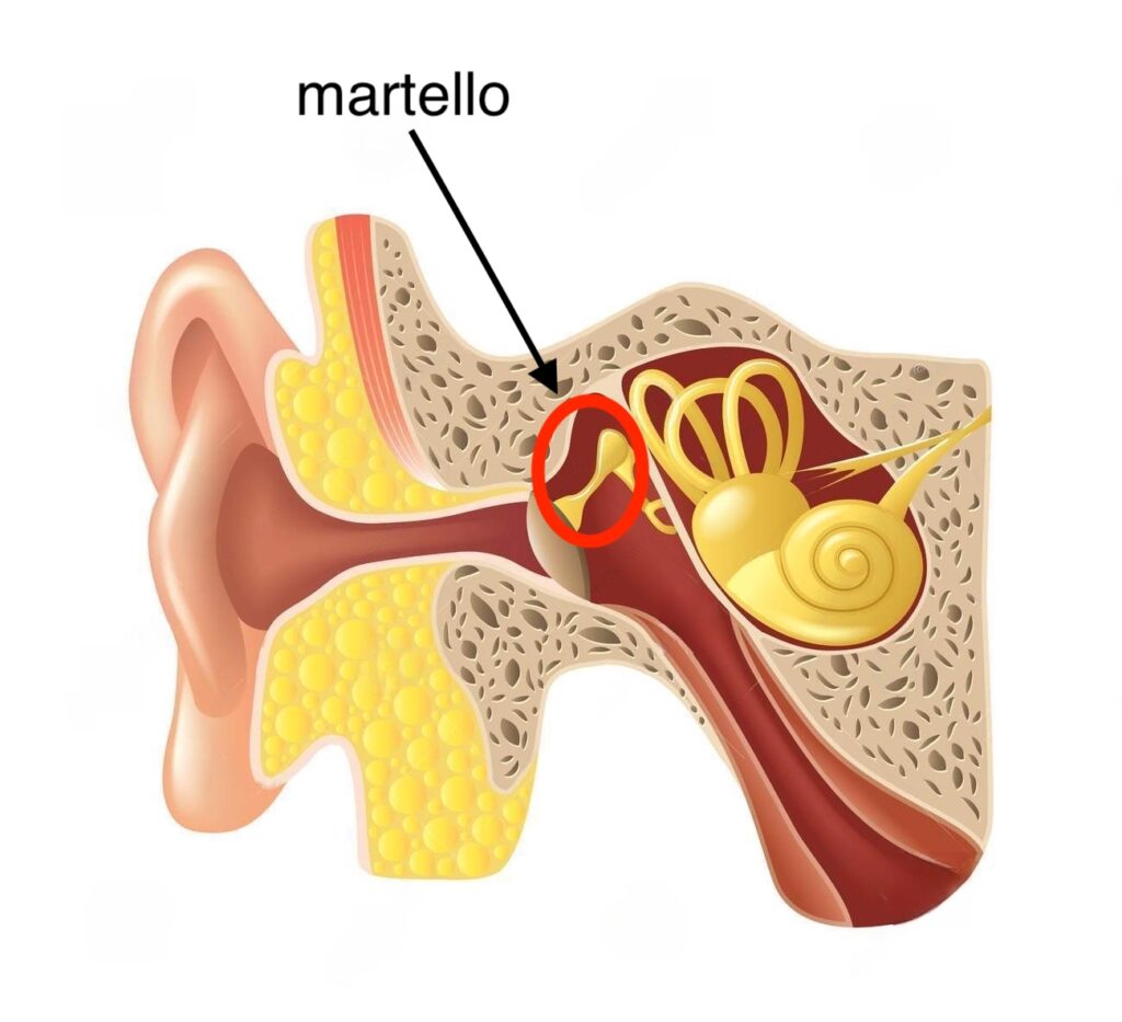 orecchio interno cause acufene martello